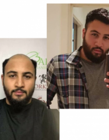Baruch Hair Loss Clinic